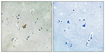 EPHA3 Antibody