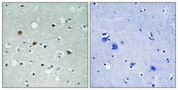 LATS1/LATS2 Antibody