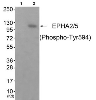 EPHA2/EPHA5 Antibody