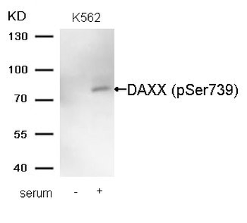 DAXX Antibody