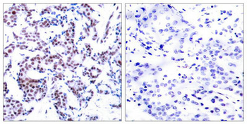 JUNB Antibody