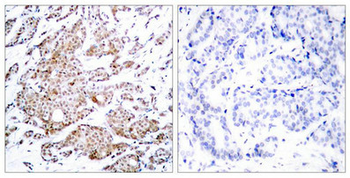 MYC Antibody