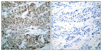 Bad Antibody