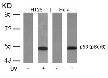 TP53 Antibody