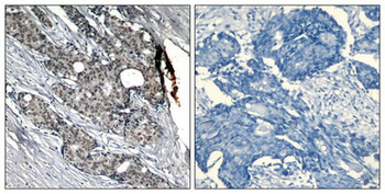 TP53 Antibody