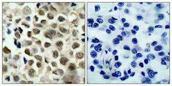 HDAC8 Antibody