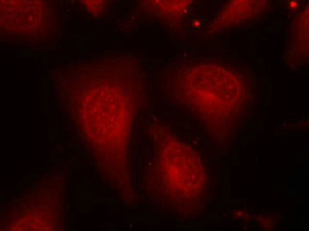 HDAC8 Antibody