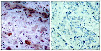 JAK1 Antibody