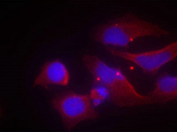 GRIN2B Antibody