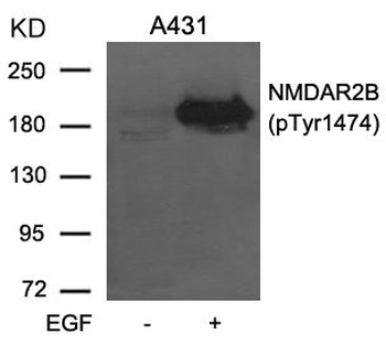 GRIN2B Antibody