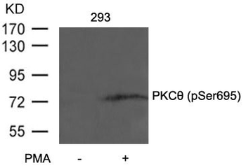 PRKCQ Antibody