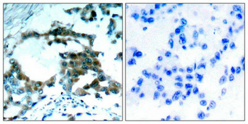 PRKCQ Antibody