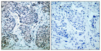 MAP2K4 Antibody