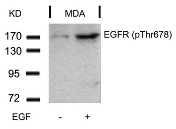 EGFR Antibody