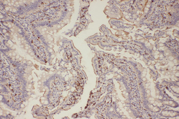EGFR Antibody