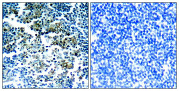 BCR Antibody