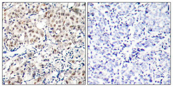 CDKN1B Antibody