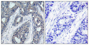 IRS1 Antibody