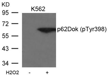 DOK1 Antibody