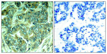 DOK1 Antibody