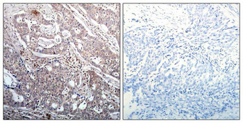 NFKBIB Antibody