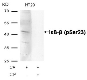 NFKBIB Antibody