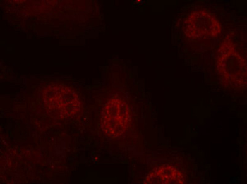 MYC Antibody