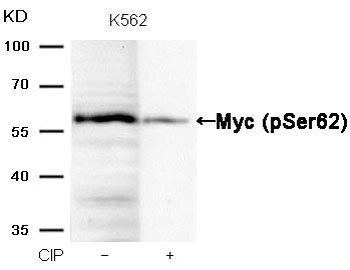 MYC Antibody