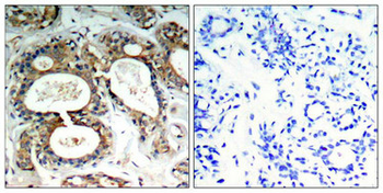 PTPN11 Antibody