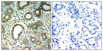 PTPN11 Antibody