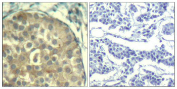 CFL1/CFL2 Antibody