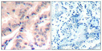 EIF4B Antibody