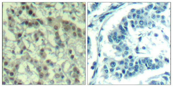 AURKA Antibody