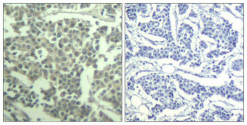 KIT Antibody