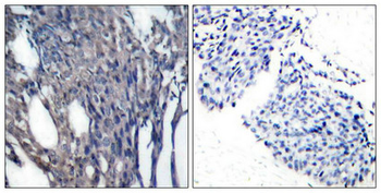 NFKBIA Antibody