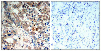 PRKAA1/PRKAA2 Antibody