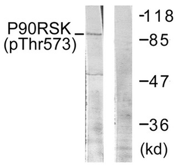 RPS6KA1 Antibody