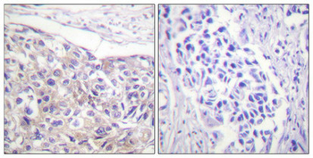 RPS6KA1 Antibody
