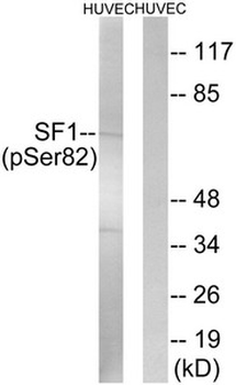 SF1 Antibody