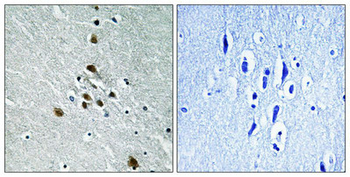 SF1 Antibody