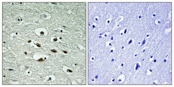CHEK1 Antibody