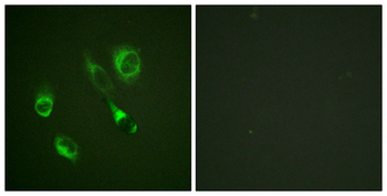 EPHA2/EPHA3/EPHA4 Antibody