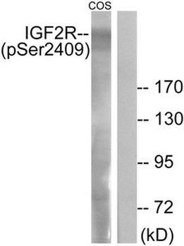 IGF2R Antibody