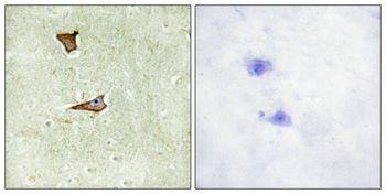 IGF2R Antibody