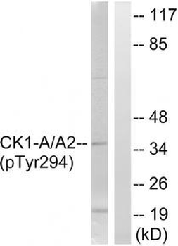 CSNK1A1/CSNK1A1L Antibody