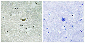 CSNK1A1/CSNK1A1L Antibody