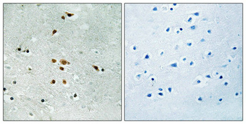 FER Antibody