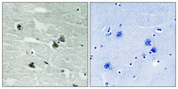 MERTK/TYRO3 Antibody