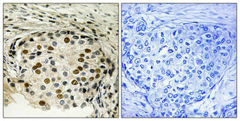 OXSR1 Antibody
