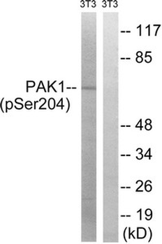 PAK1 Antibody